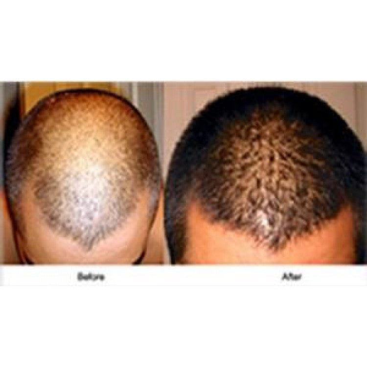 Pakistan Hair Building Fiber Oil